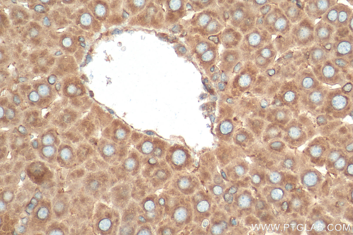 Immunohistochemistry (IHC) staining of mouse liver tissue using GANAB Polyclonal antibody (29183-1-AP)