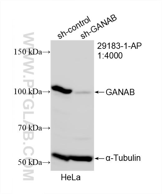 Western Blot (WB) analysis of HeLa cells using GANAB Polyclonal antibody (29183-1-AP)