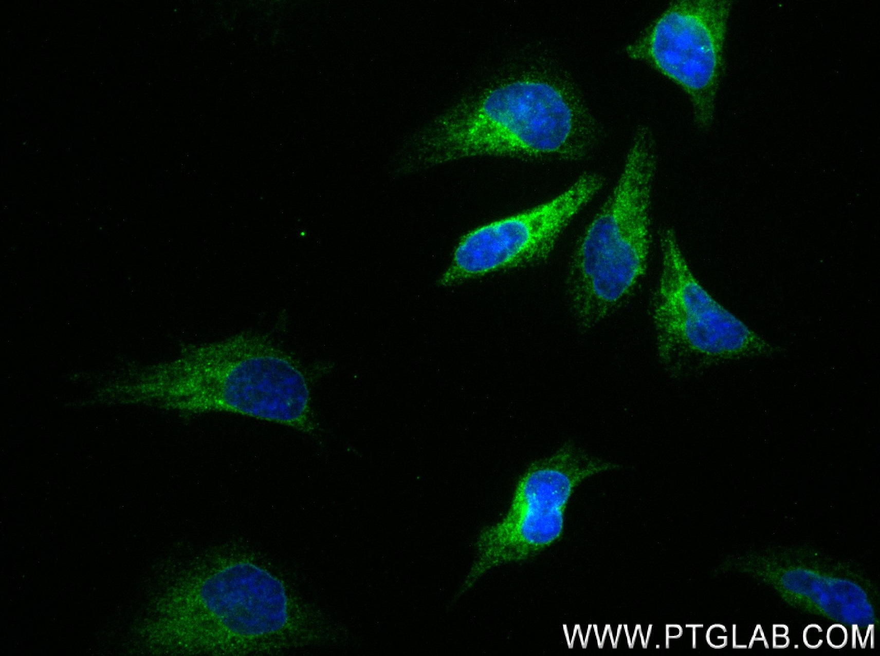 Immunofluorescence (IF) / fluorescent staining of HeLa cells using GANAB Recombinant antibody (83324-1-RR)