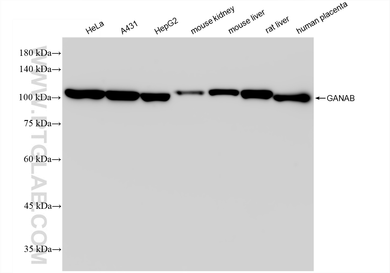 Western Blot (WB) analysis of various lysates using GANAB Recombinant antibody (83324-1-RR)