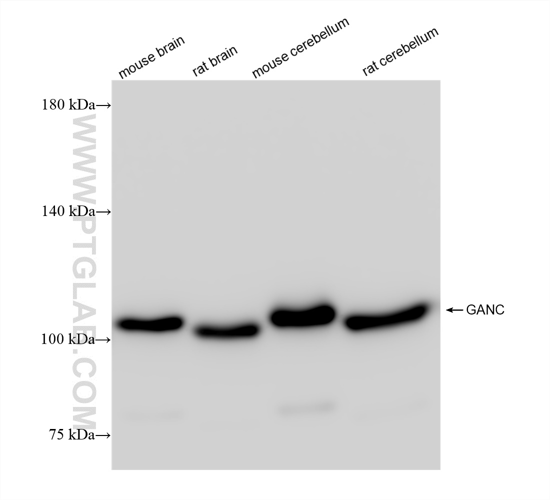 Western Blot (WB) analysis of various lysates using GANC Recombinant antibody (84676-3-RR)