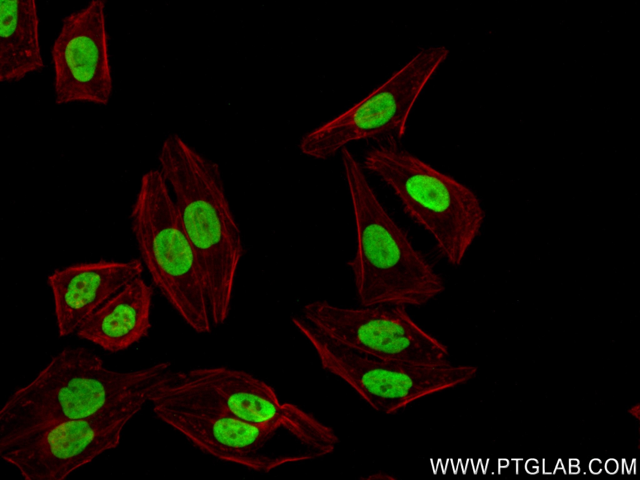 Immunofluorescence (IF) / fluorescent staining of HepG2 cells using GAR1 Recombinant antibody (83577-1-RR)