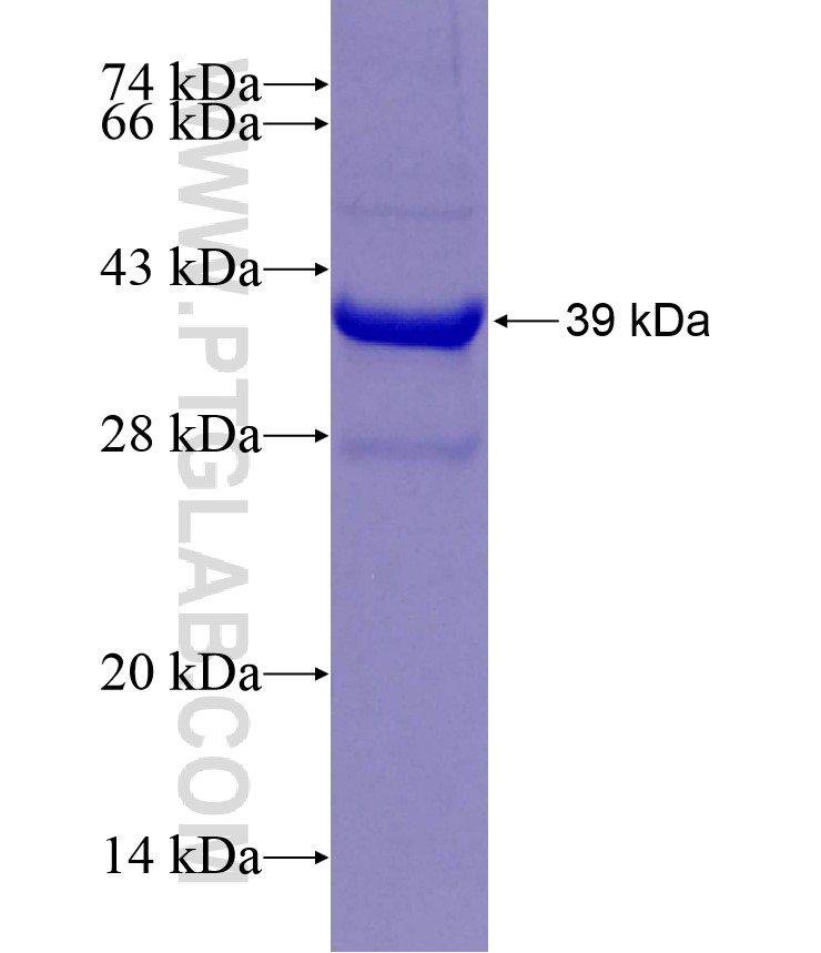 GAS2 fusion protein Ag29486 SDS-PAGE