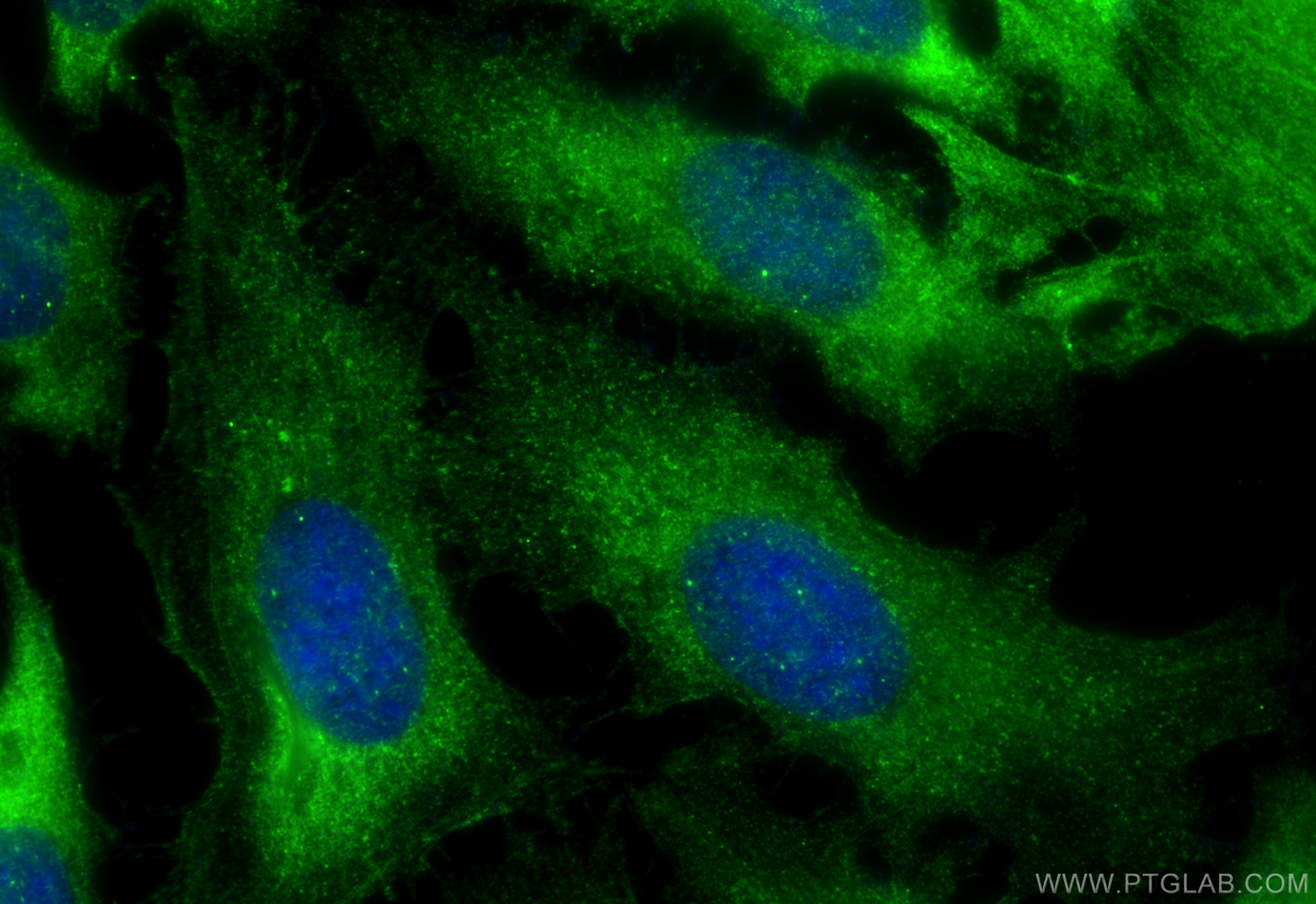 Immunofluorescence (IF) / fluorescent staining of HeLa cells using GAS7 Polyclonal antibody (10072-1-AP)