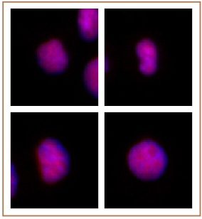 GATA-6 antibody (pAb) tested by immunofluorescence. Formaldehyde fixed HeLa cells stained with GATA-6 antibody at a 1:2,000 dilution.