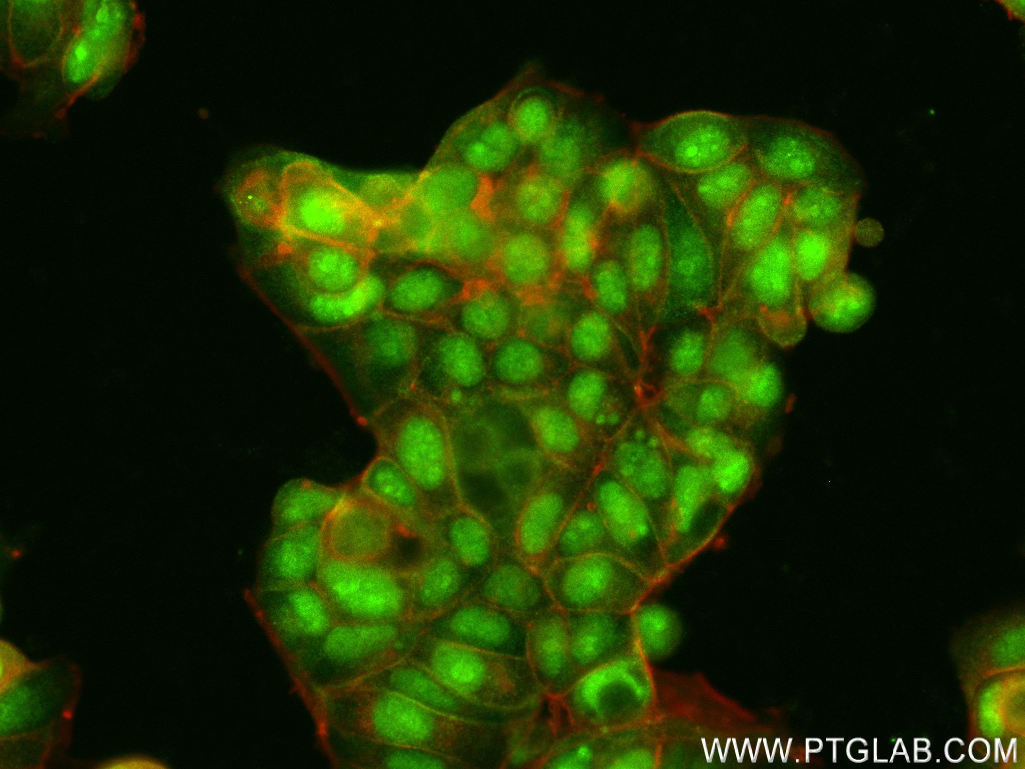 Immunofluorescence (IF) / fluorescent staining of MCF-7 cells using GATA3 Recombinant antibody (83808-2-RR)