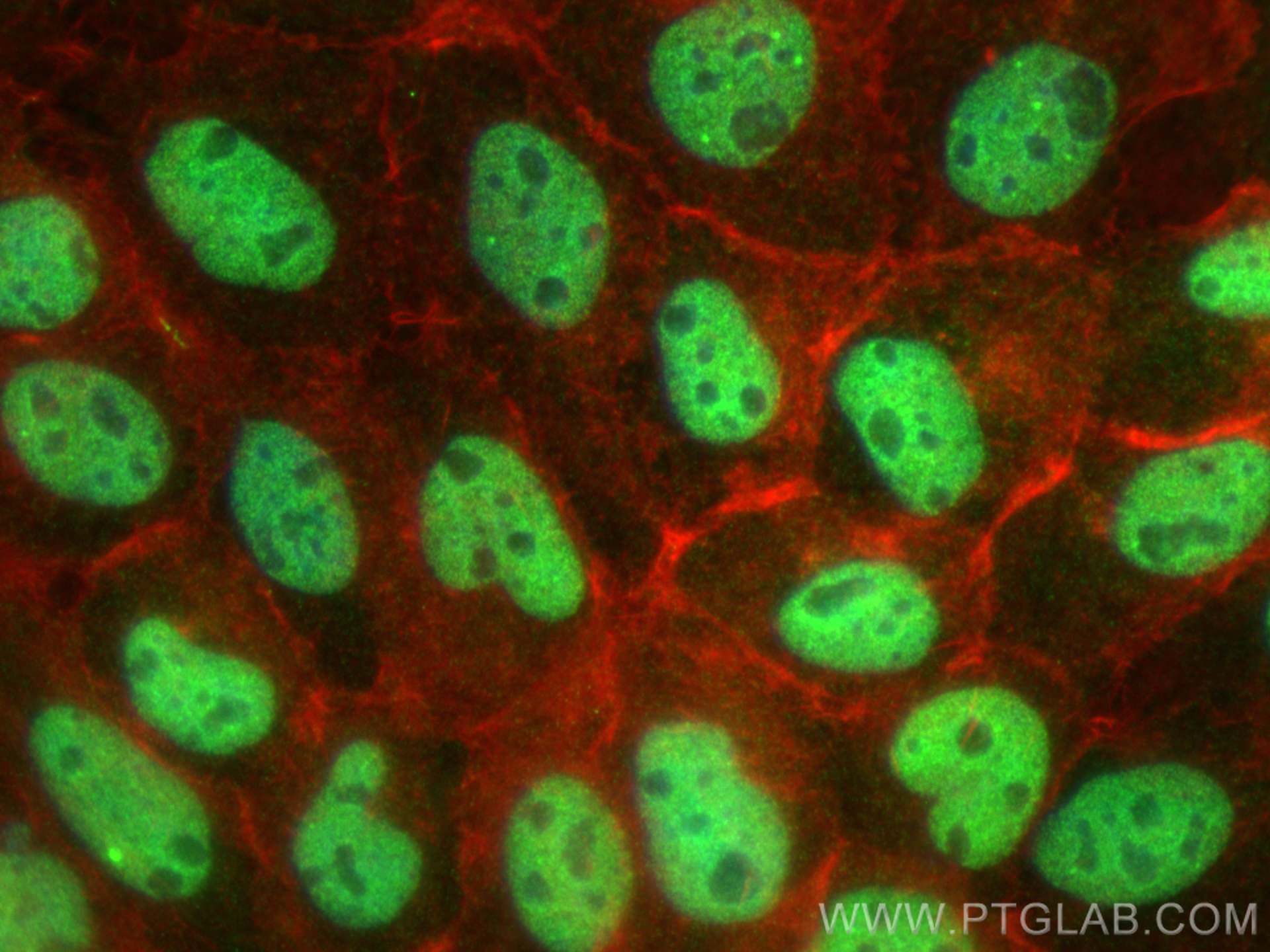 Immunofluorescence (IF) / fluorescent staining of A431 cells using GATAD2B Polyclonal antibody (25679-1-AP)