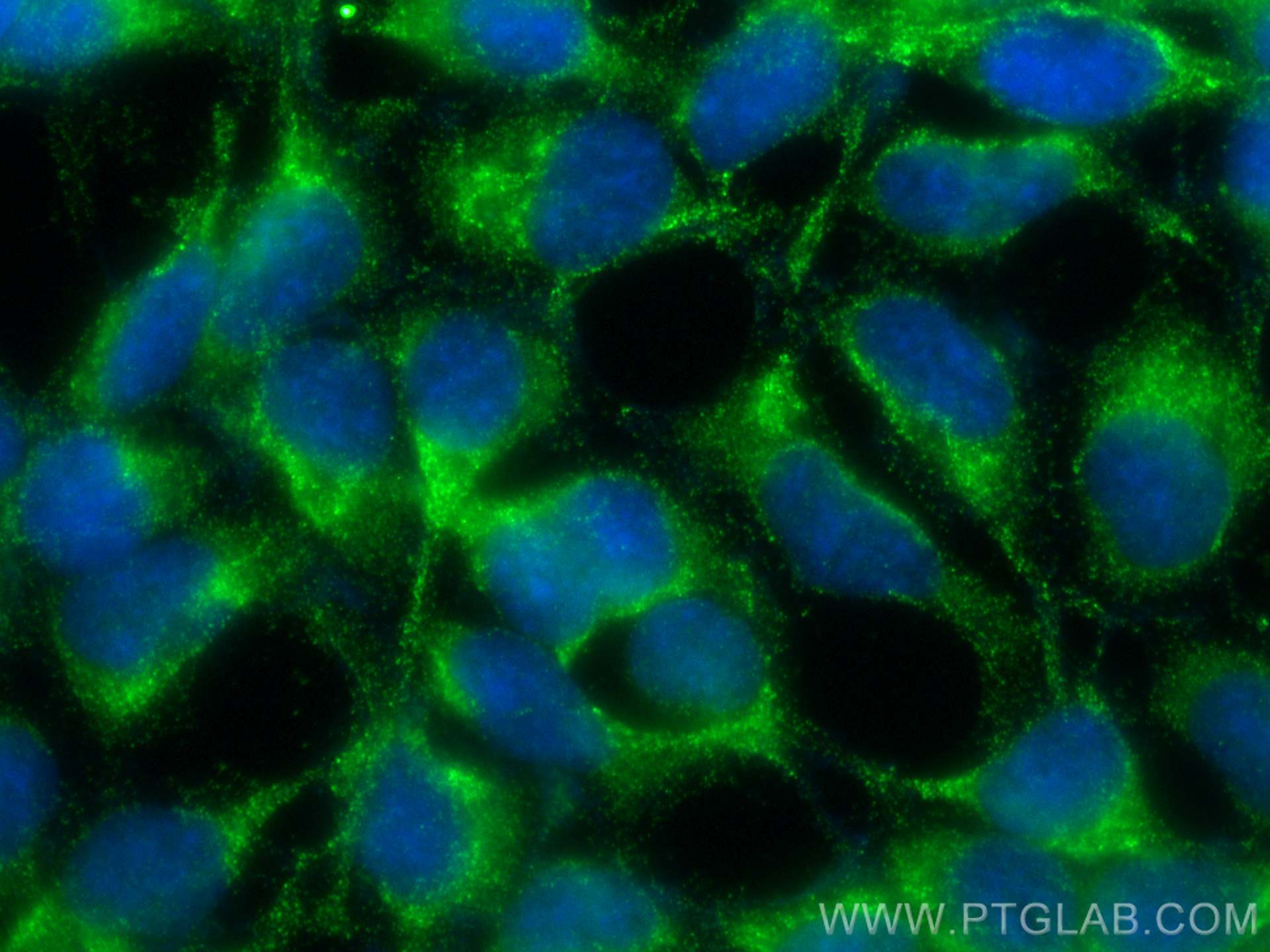 Immunofluorescence (IF) / fluorescent staining of HEK-293 cells using GATC Monoclonal antibody (68405-1-Ig)