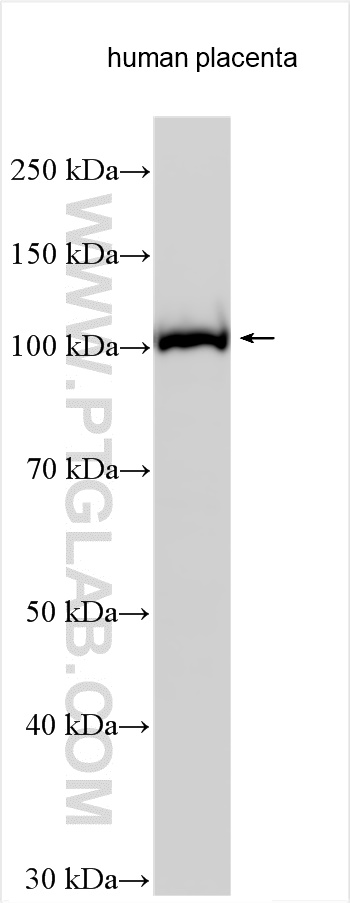 Western Blot (WB) analysis of various lysates using GBA2 Polyclonal antibody (17164-1-AP)