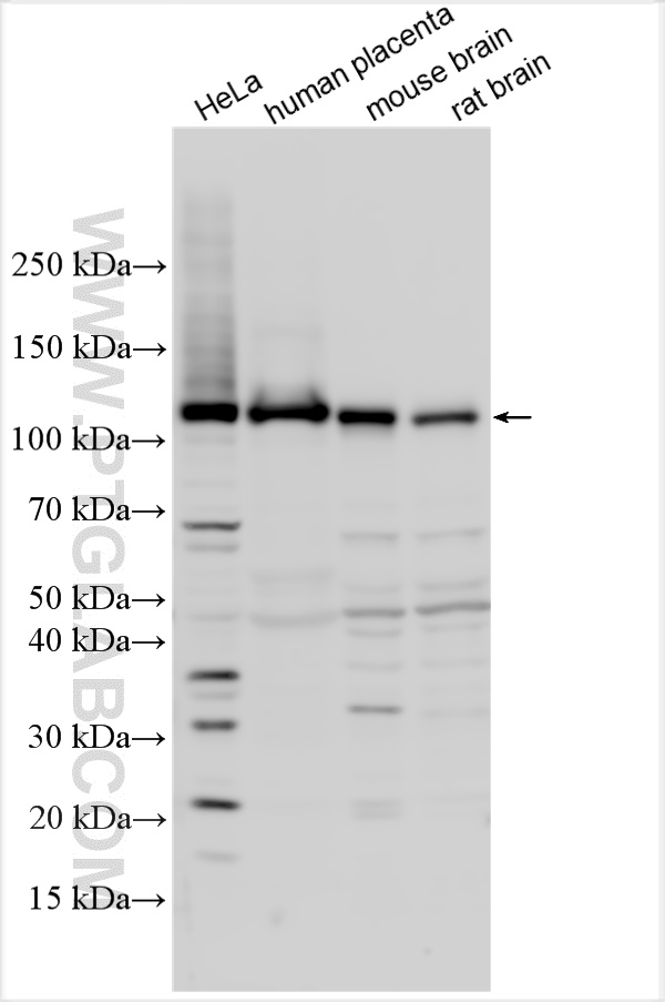 Western Blot (WB) analysis of various lysates using GBA2 Polyclonal antibody (17164-1-AP)