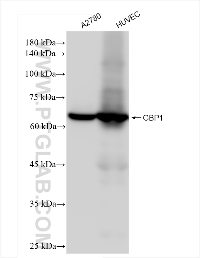 Western Blot (WB) analysis of various lysates using GBP1 Recombinant antibody (83751-6-RR)