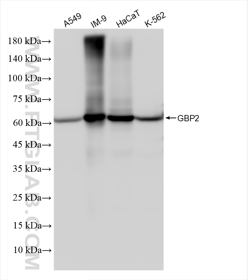 Western Blot (WB) analysis of various lysates using GBP2 Recombinant antibody (84264-6-RR)