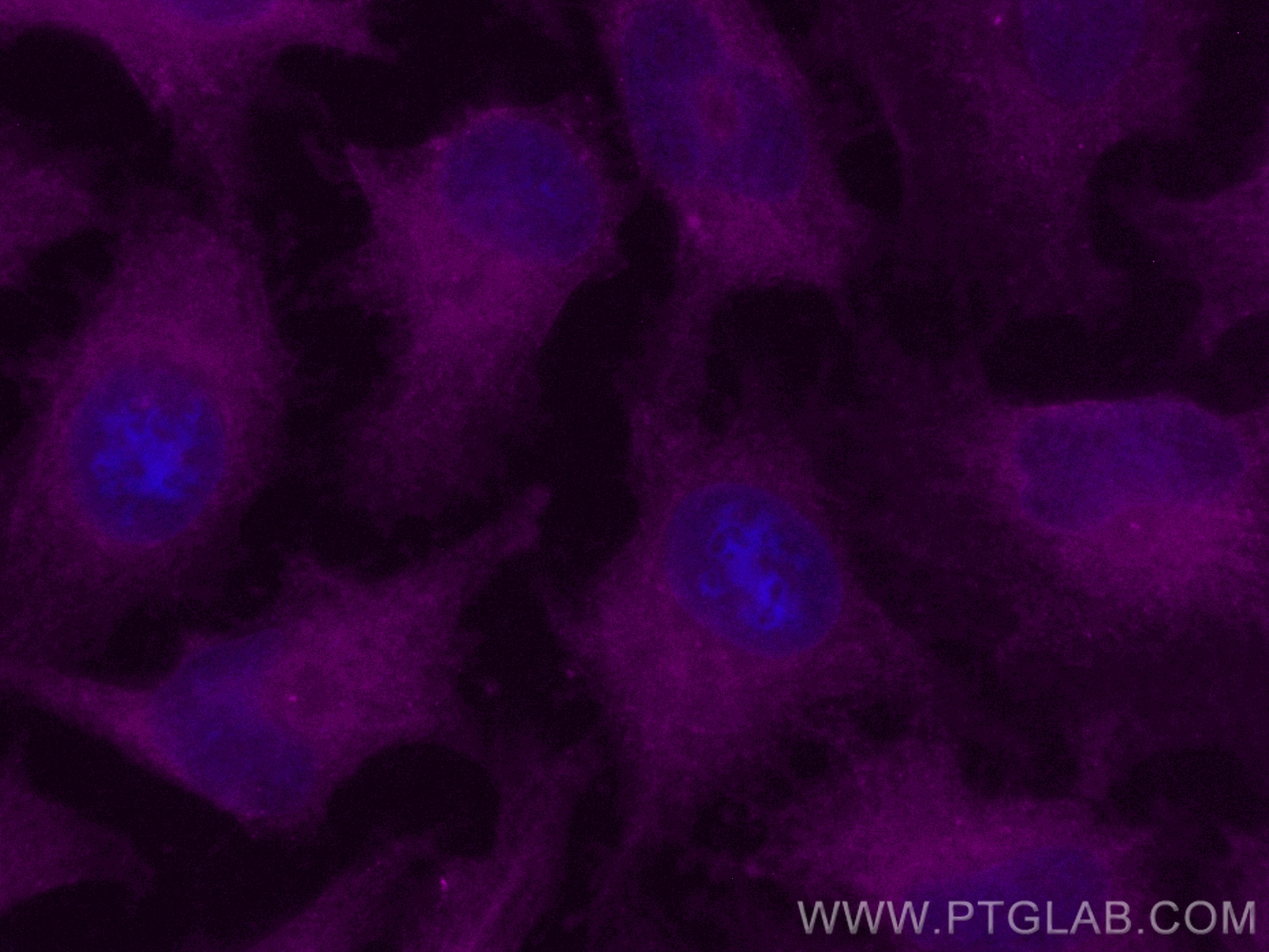 Immunofluorescence (IF) / fluorescent staining of HeLa cells using CoraLite® Plus 647-conjugated GBP2 Polyclonal anti (CL647-11854)