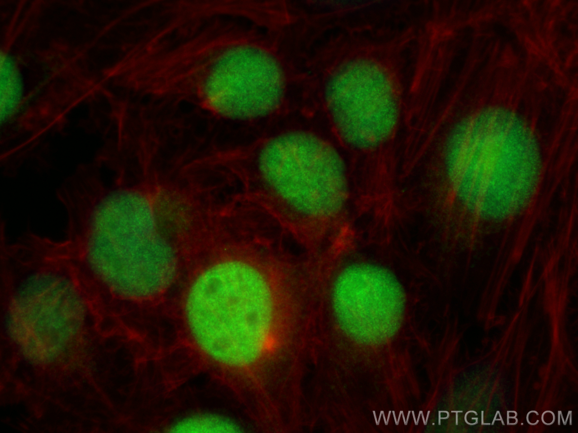 Immunofluorescence (IF) / fluorescent staining of HeLa cells using GBX2 Polyclonal antibody (21639-1-AP)