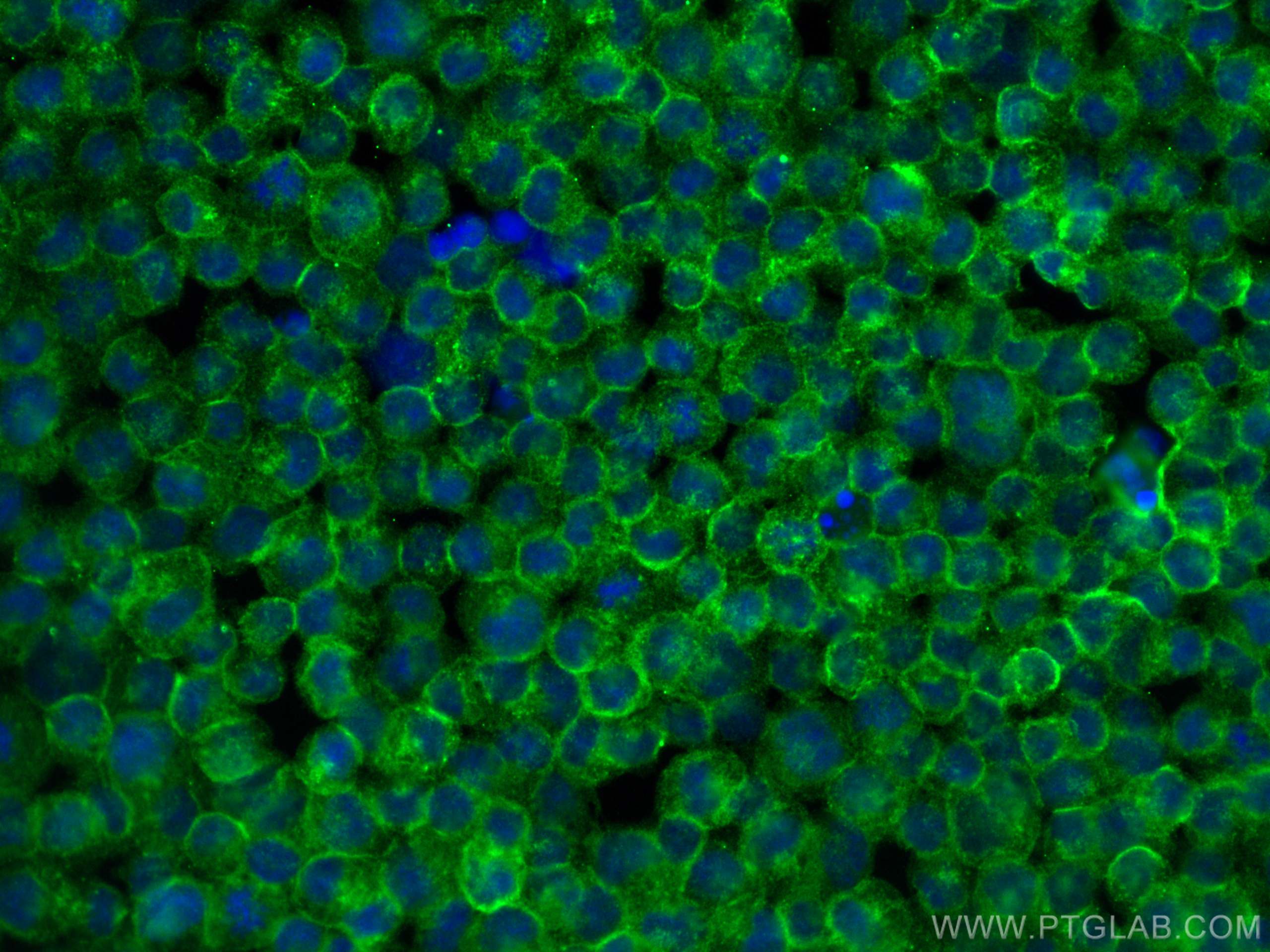 Immunofluorescence (IF) / fluorescent staining of Raji cells using GCET2 Polyclonal antibody (13447-1-AP)