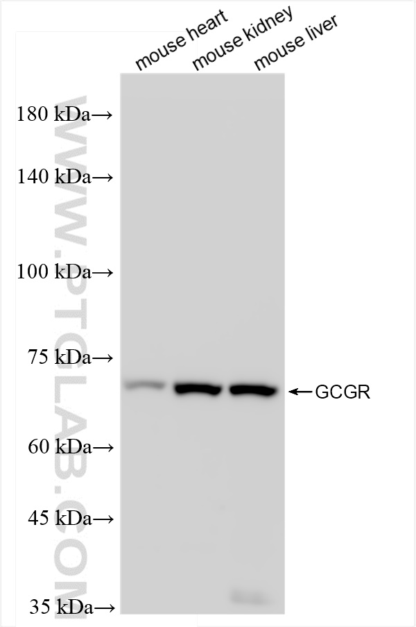 Western Blot (WB) analysis of various lysates using GCGR Recombinant antibody (84237-5-RR)