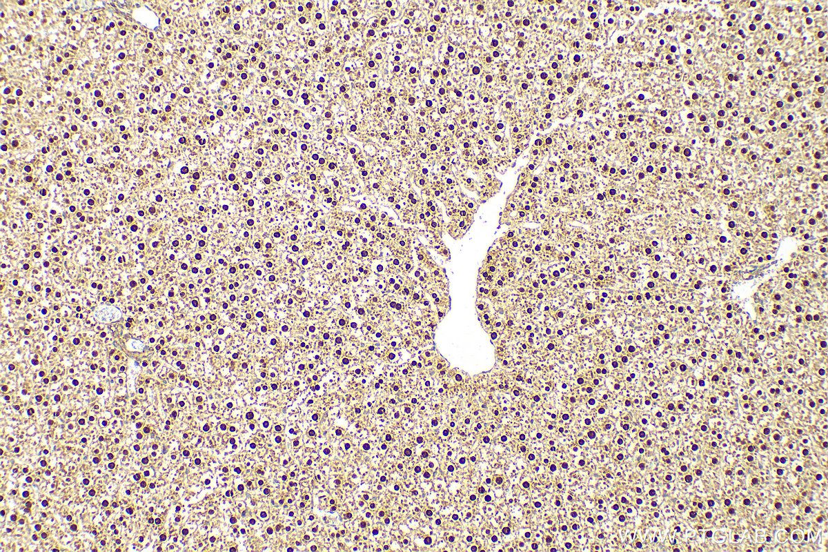 Immunohistochemistry (IHC) staining of rat liver tissue using GCK Polyclonal antibody (15629-1-AP)