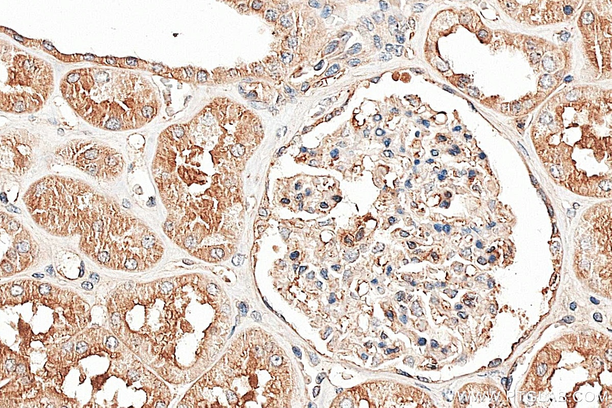 Immunohistochemistry (IHC) staining of human kidney tissue using GCLC Polyclonal antibody (12601-1-AP)
