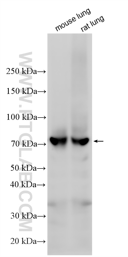 Western Blot (WB) analysis of various lysates using GCLC Polyclonal antibody (12601-1-AP)