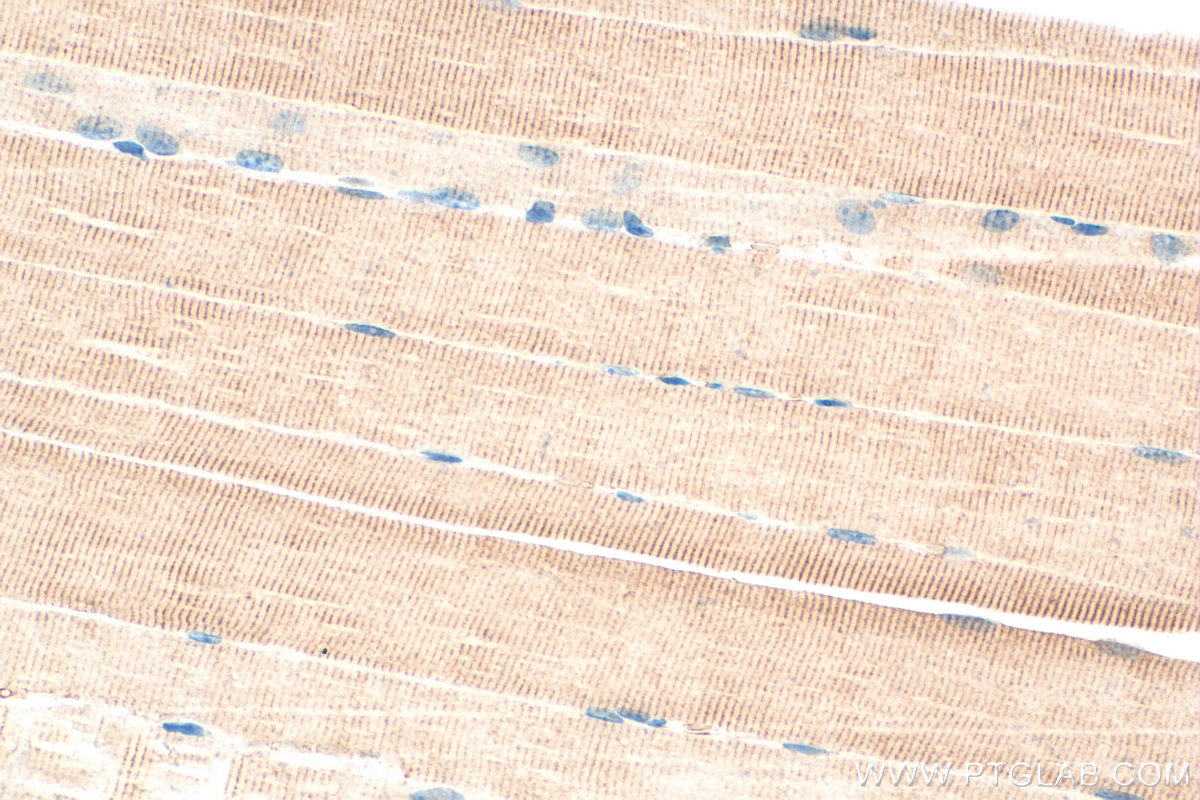 Immunohistochemistry (IHC) staining of mouse skeletal muscle tissue using GCLM Polyclonal antibody (14241-1-AP)