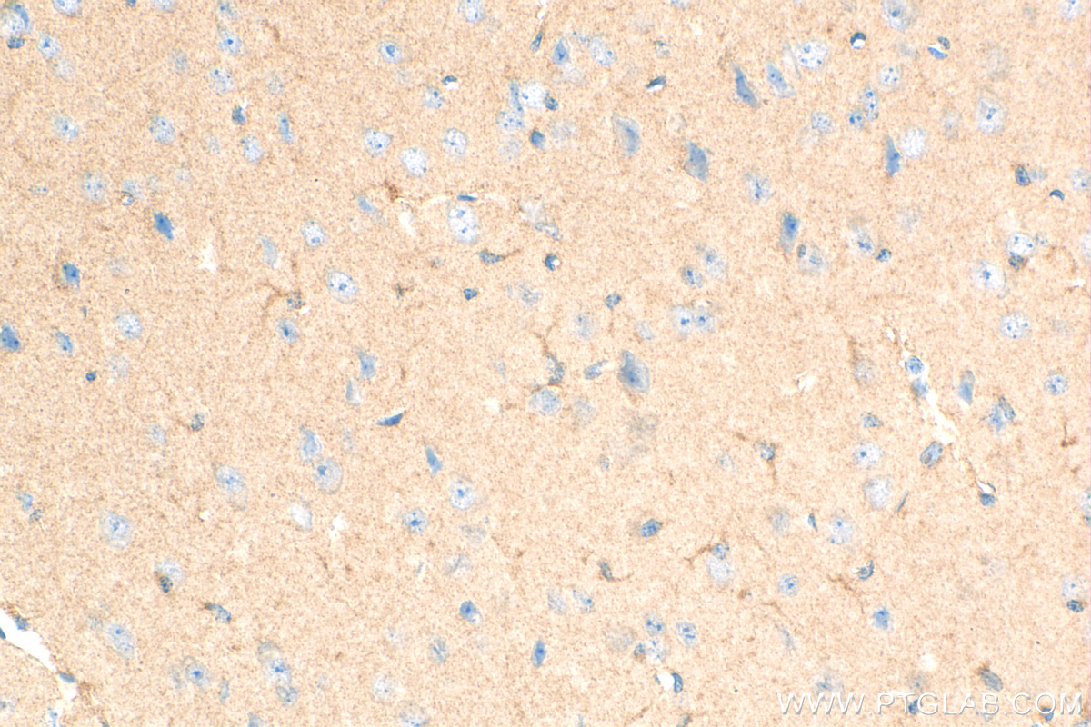 Immunohistochemistry (IHC) staining of mouse brain tissue using GCLM Recombinant antibody (82623-1-RR)