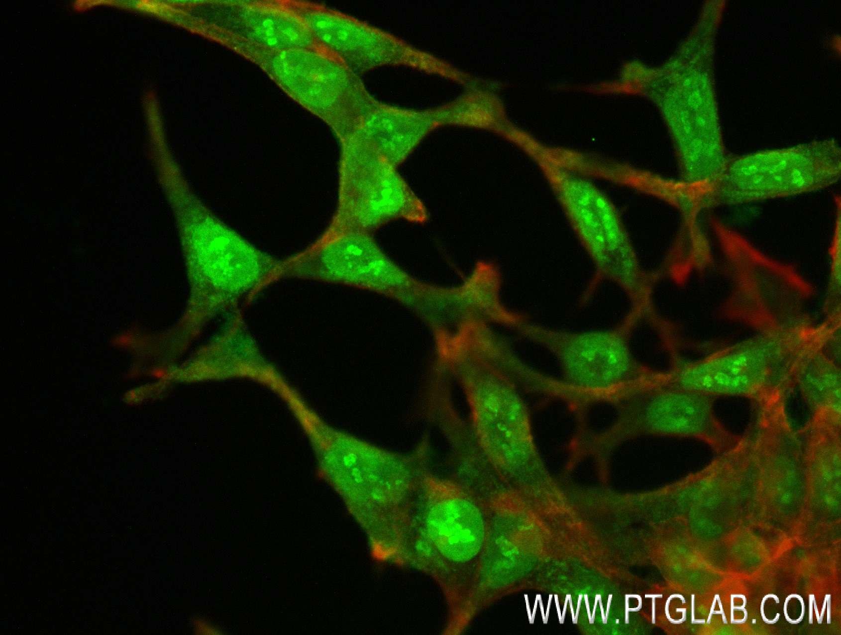 Immunofluorescence (IF) / fluorescent staining of LNCaP cells using GCNA Recombinant antibody (84124-4-RR)