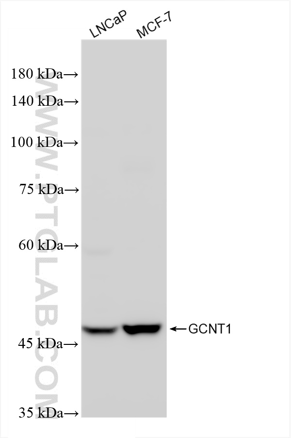 Western Blot (WB) analysis of various lysates using GCNT1 Recombinant antibody (83121-4-RR)