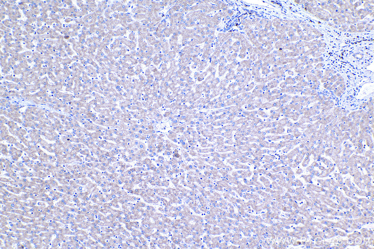 Immunohistochemistry (IHC) staining of human liver tissue using GCNT2 Polyclonal antibody (18118-1-AP)