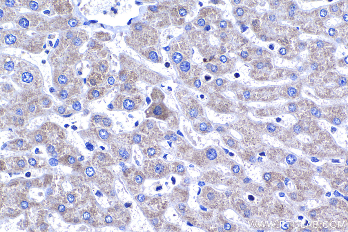 Immunohistochemistry (IHC) staining of human liver tissue using GCNT2 Polyclonal antibody (18118-1-AP)