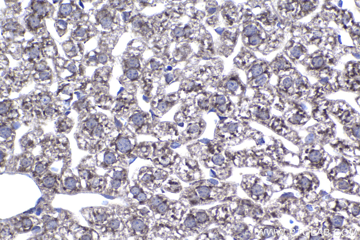 Immunohistochemistry (IHC) staining of mouse liver tissue using GCNT2 Polyclonal antibody (18118-1-AP)