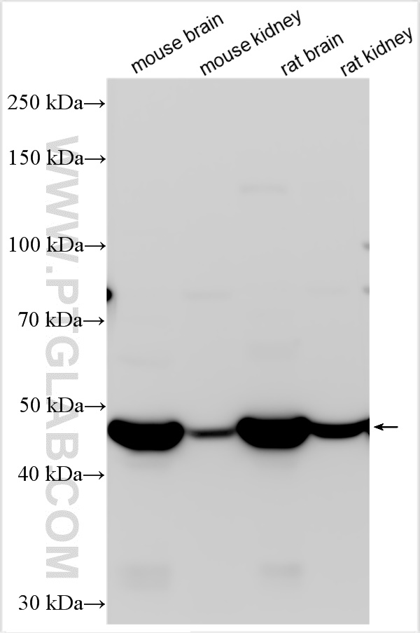 Western Blot (WB) analysis of various lysates using GDA Polyclonal antibody (31493-1-AP)