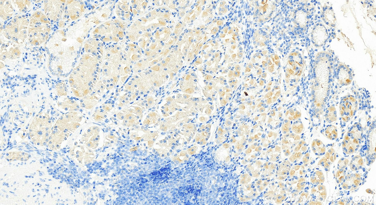 Immunohistochemistry (IHC) staining of human stomach tissue using GDAP2 Polyclonal antibody (17246-1-AP)