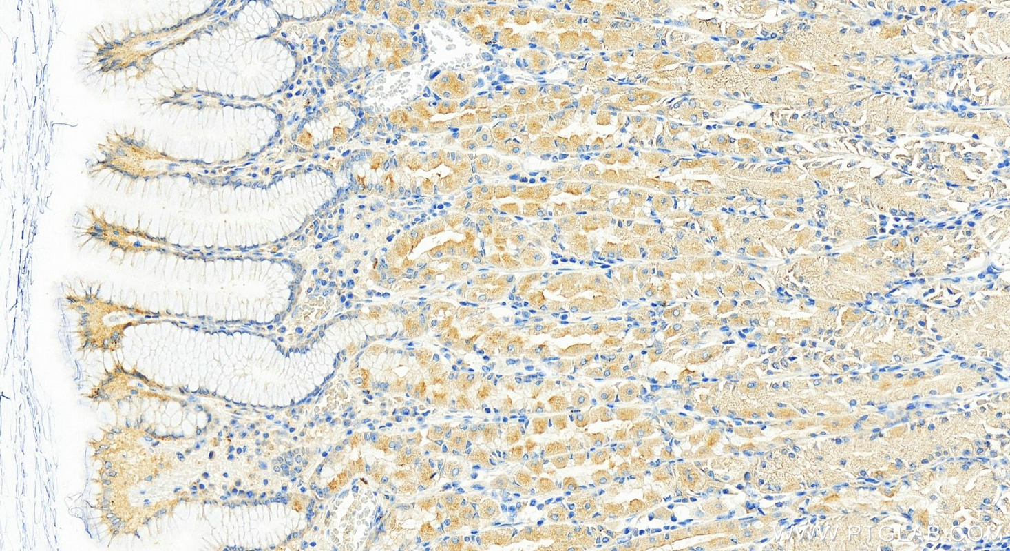 Immunohistochemistry (IHC) staining of human stomach tissue using GDAP2 Polyclonal antibody (17246-1-AP)