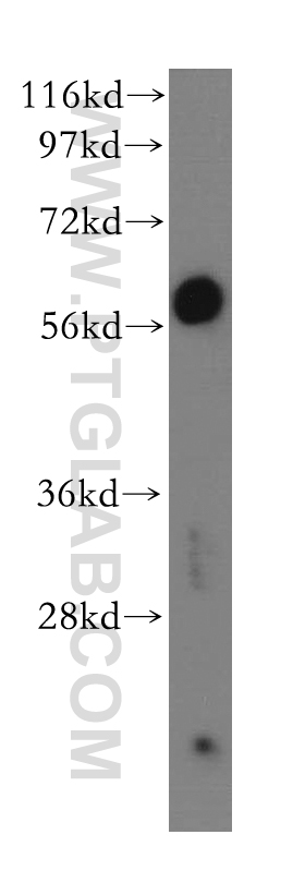 Western Blot (WB) analysis of PC-3 cells using GDE1 Polyclonal antibody (11272-2-AP)