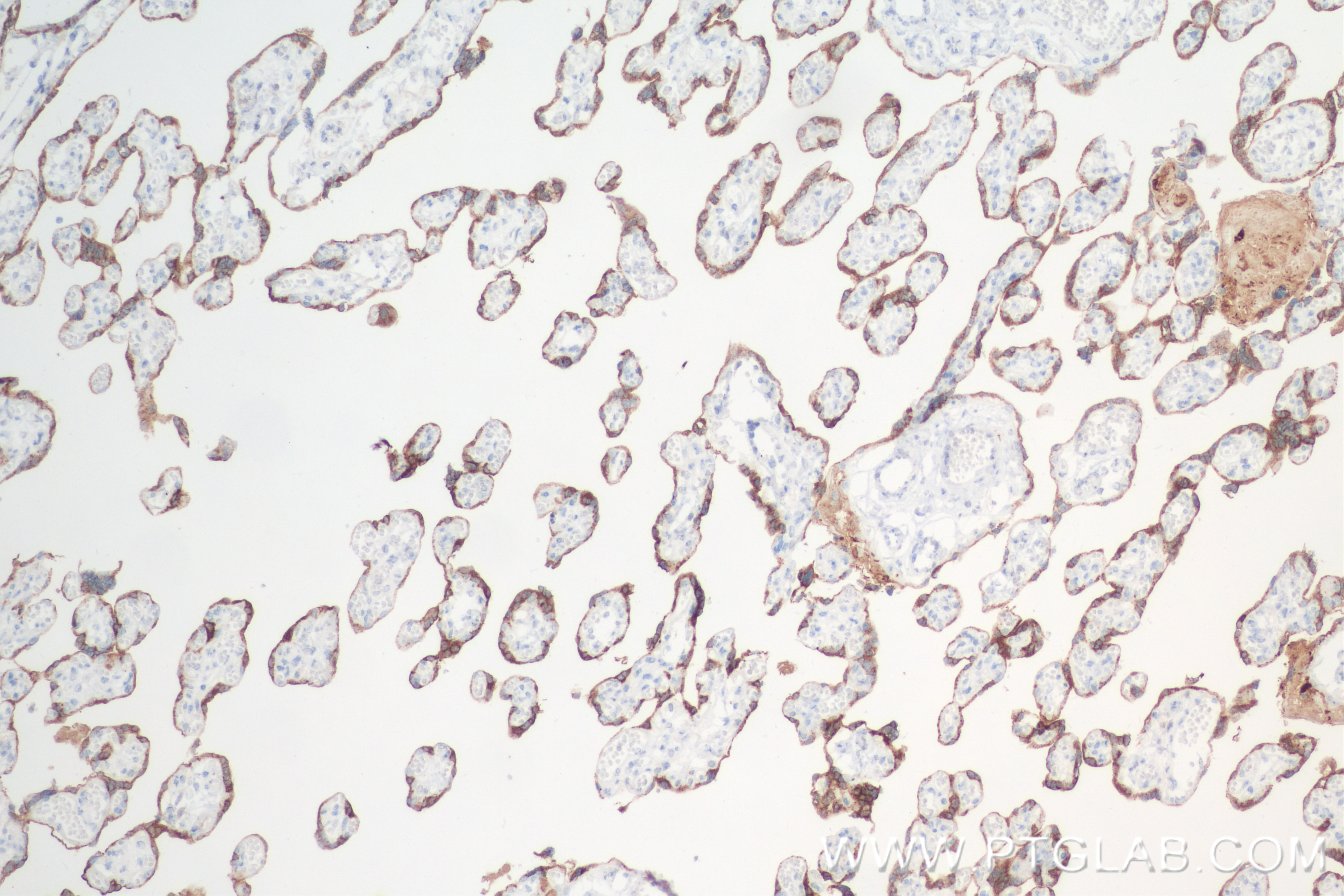 Immunohistochemistry (IHC) staining of human placenta tissue using GDF-15 Recombinant antibody (85100-1-RR)