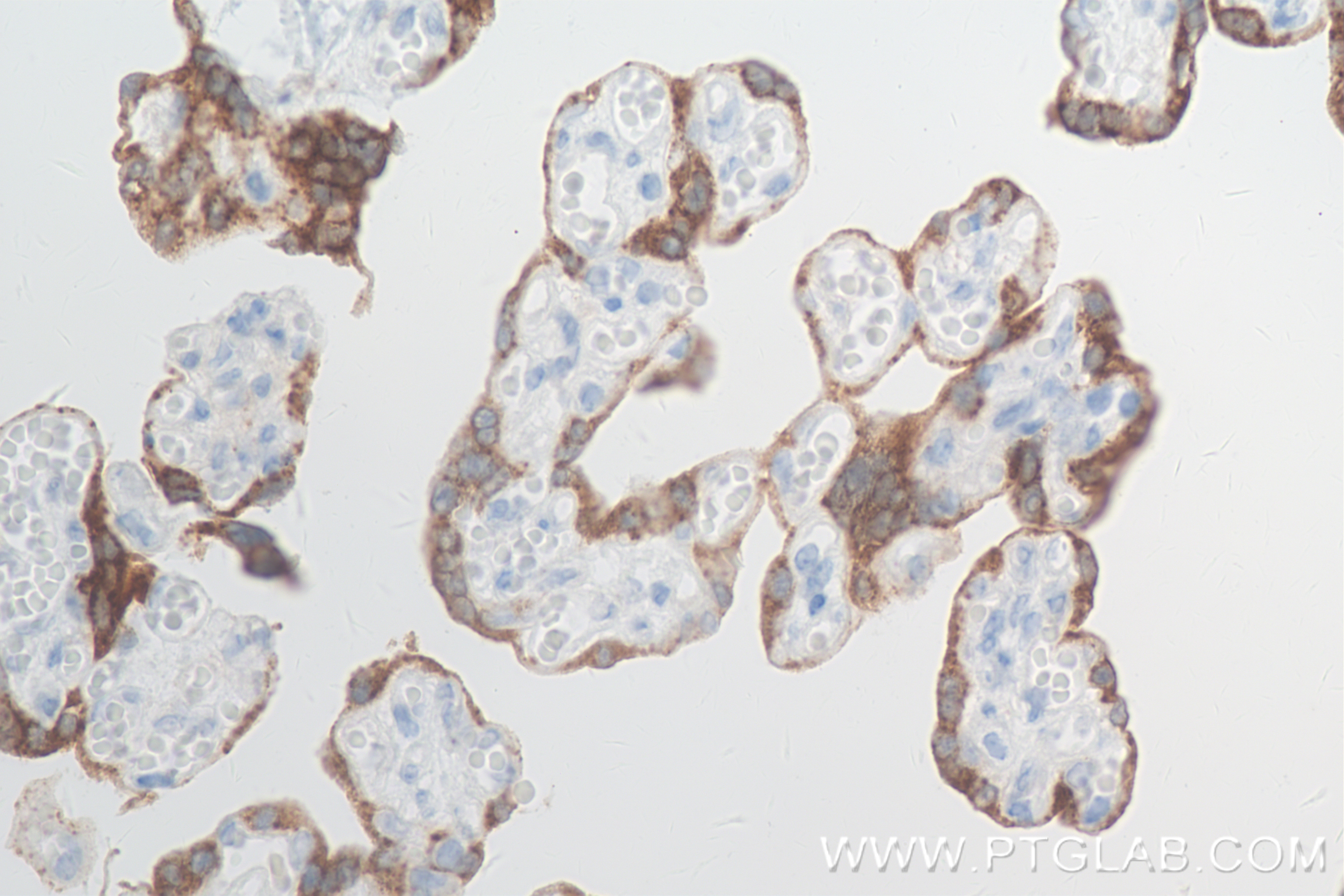 Immunohistochemistry (IHC) staining of human placenta tissue using GDF-15 Recombinant antibody (85100-1-RR)