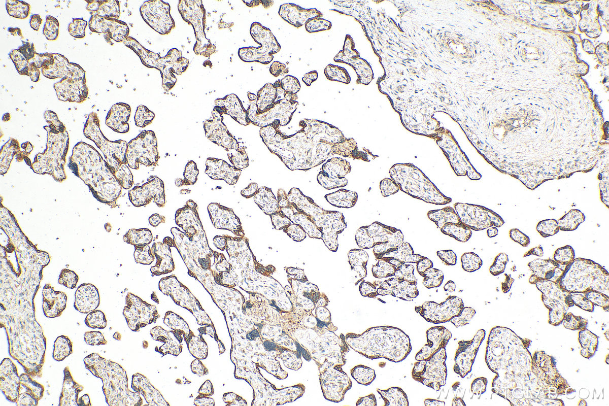 Immunohistochemistry (IHC) staining of human placenta tissue using GDF-15 Polyclonal antibody (27845-1-AP)