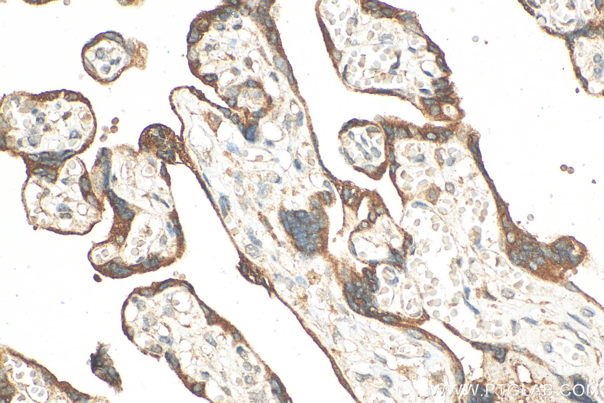 Immunohistochemistry (IHC) staining of human placenta tissue using GDF-15 Polyclonal antibody (27845-1-AP)