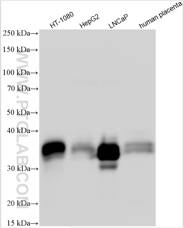 Western Blot (WB) analysis of various lysates using GDF15 Polyclonal antibody (27845-1-AP)