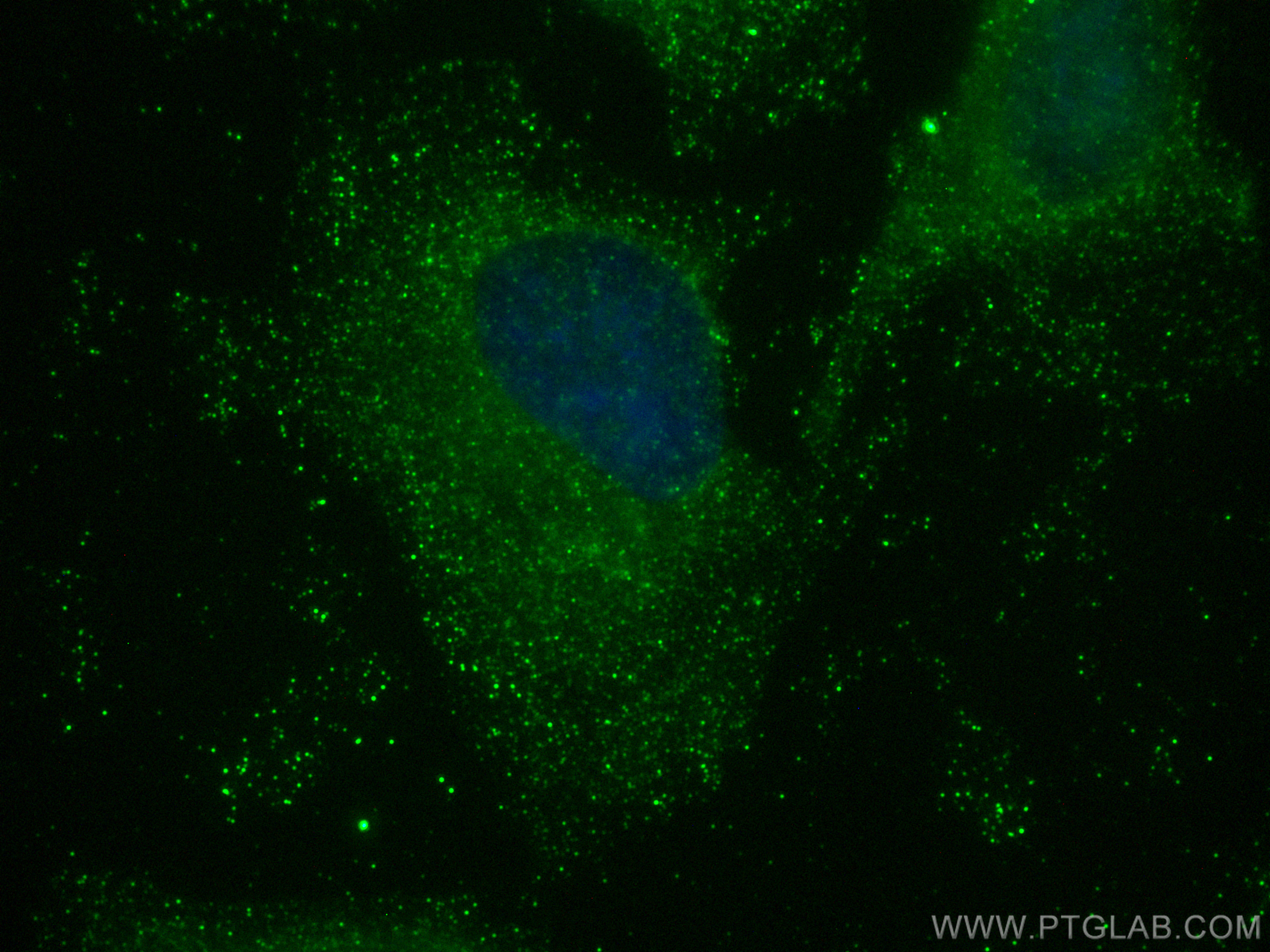 Immunofluorescence (IF) / fluorescent staining of HeLa cells using GDF-15 Monoclonal antibody (68768-1-Ig)