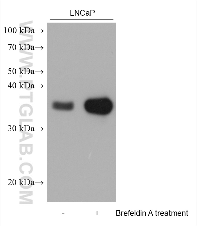 Western Blot (WB) analysis of various lysates using GDF15 Monoclonal antibody (68768-1-Ig)