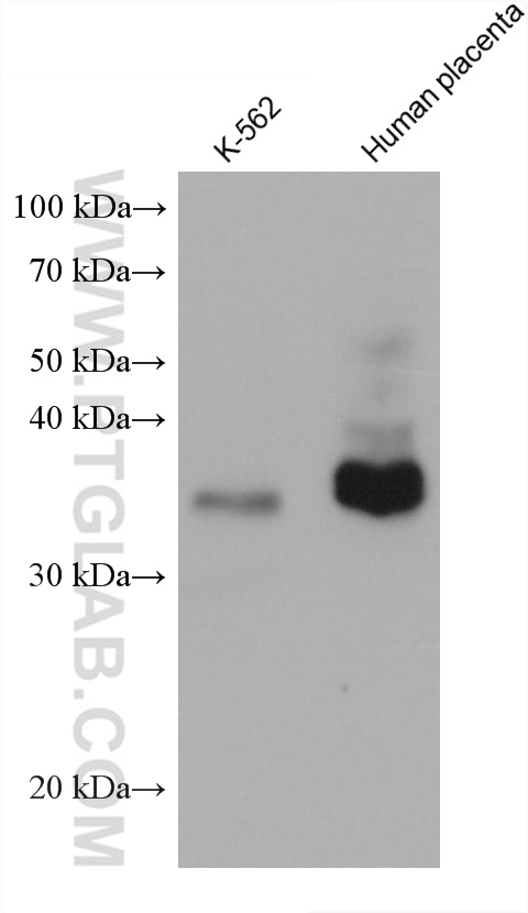 Western Blot (WB) analysis of various lysates using GDF15 Monoclonal antibody (68768-1-Ig)