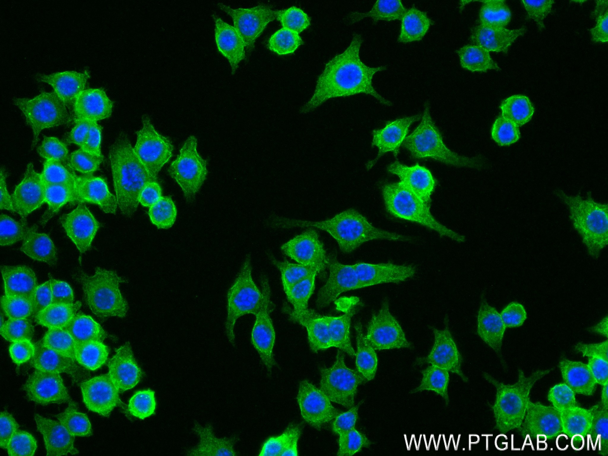 Immunofluorescence (IF) / fluorescent staining of RAW 264.7 cells using GDF5 Recombinant antibody (83988-4-RR)