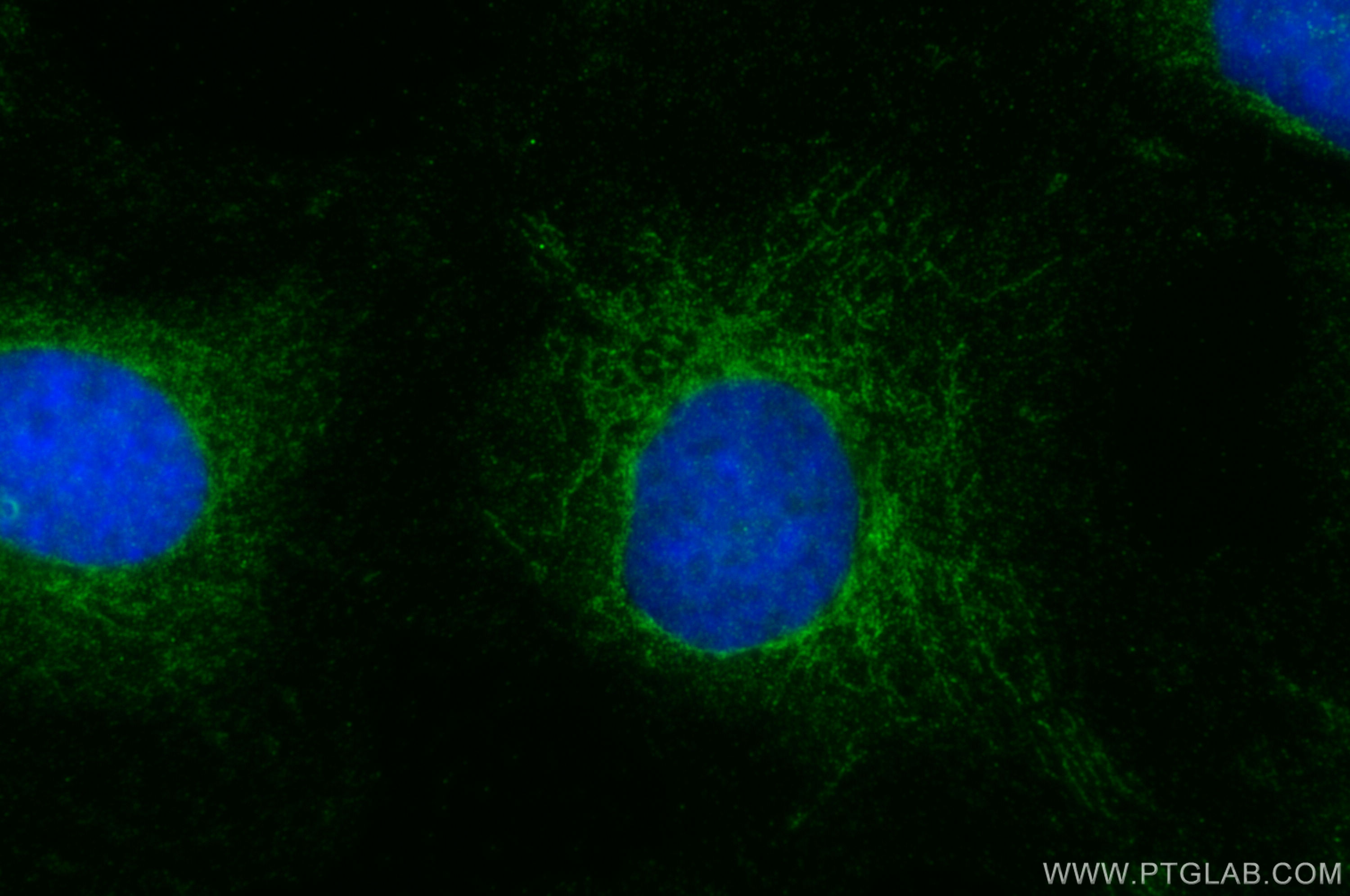 Immunofluorescence (IF) / fluorescent staining of SKOV-3 cells using GDF9 Polyclonal antibody (29309-1-AP)