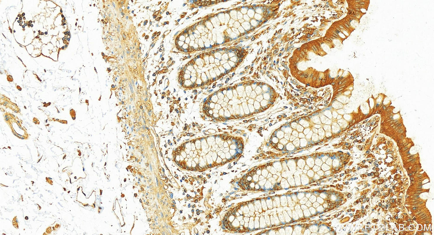 Immunohistochemistry (IHC) staining of human colon tissue using GDI2 Polyclonal antibody (10116-1-AP)