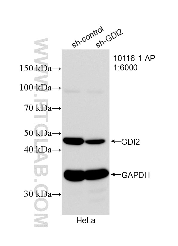 Western Blot (WB) analysis of HeLa cells using GDI2 Polyclonal antibody (10116-1-AP)