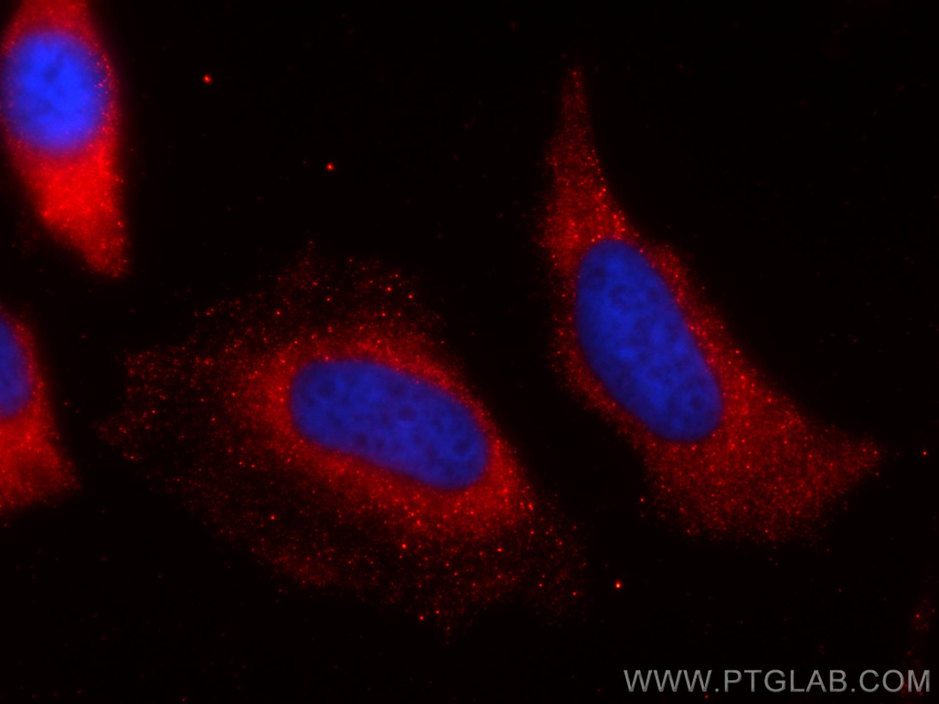 Immunofluorescence (IF) / fluorescent staining of HeLa cells using CoraLite®594-conjugated GDI2 Monoclonal antibody (CL594-60078)