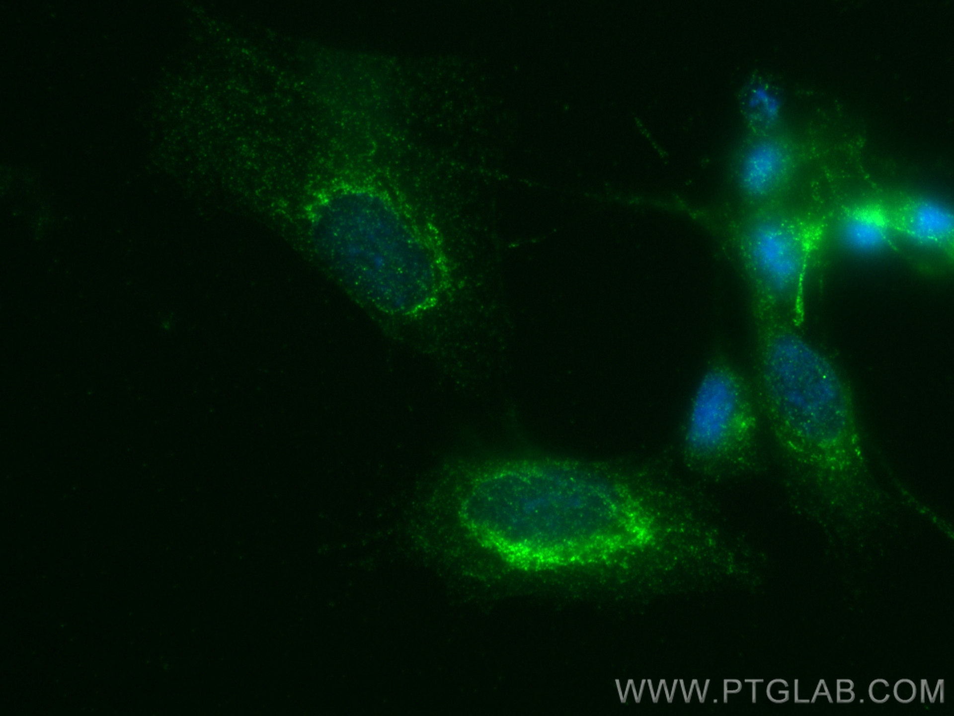 Immunofluorescence (IF) / fluorescent staining of SH-SY5Y cells using GDNF Recombinant antibody (83087-1-RR)