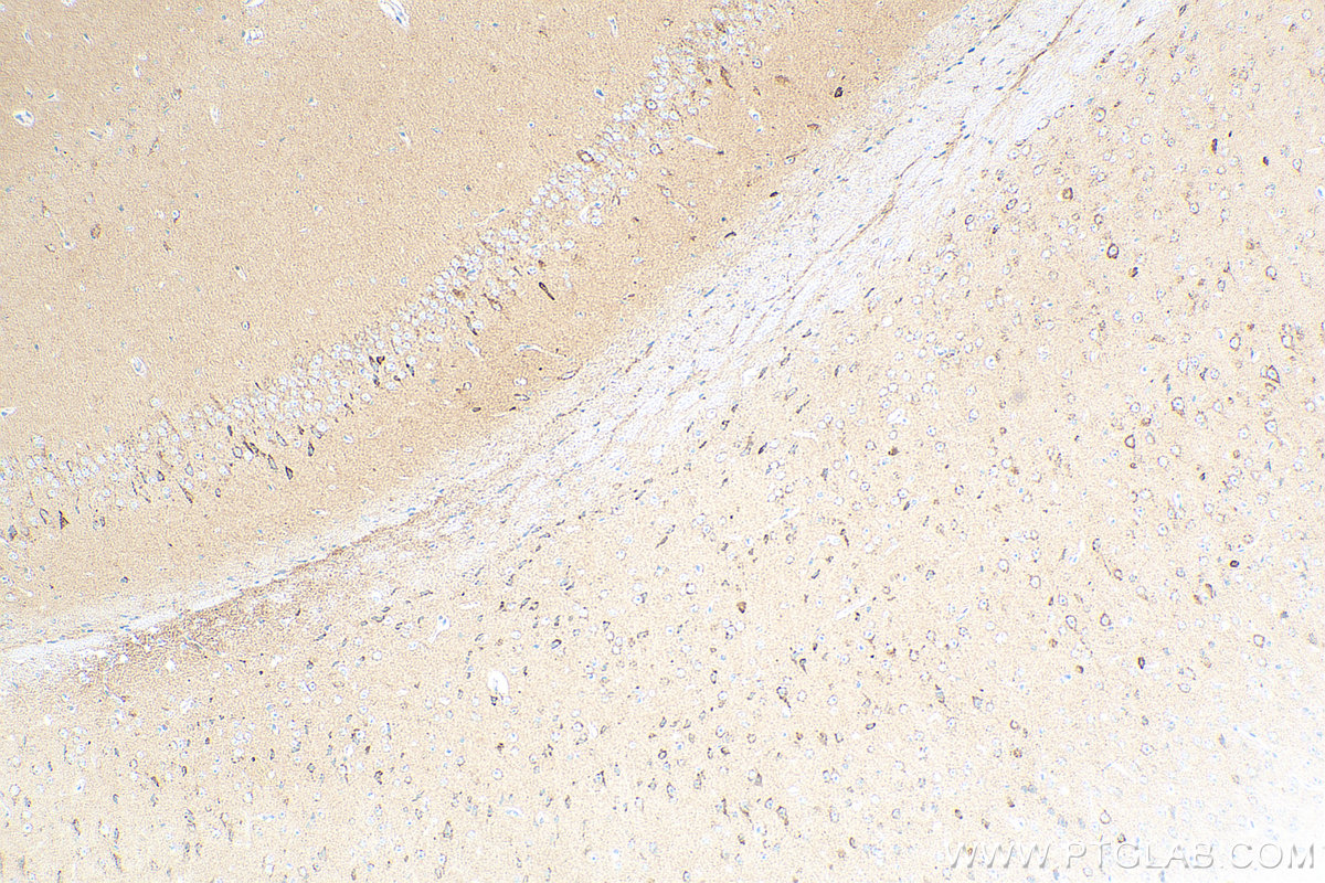 Immunohistochemistry (IHC) staining of mouse brain tissue using GDNF Recombinant antibody (83087-1-RR)