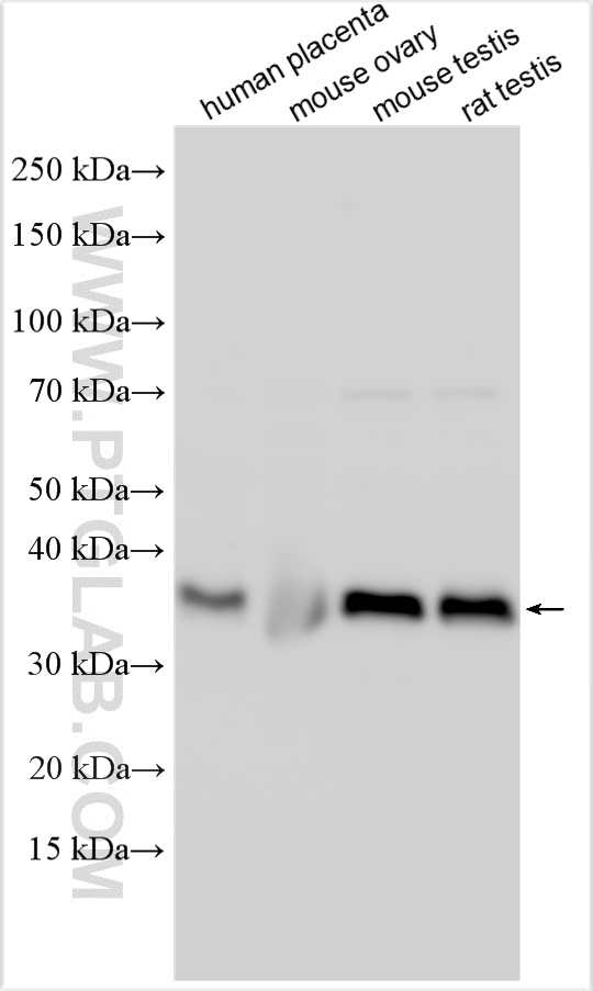 Western Blot (WB) analysis of various lysates using GDPD1 Polyclonal antibody (27861-1-AP)